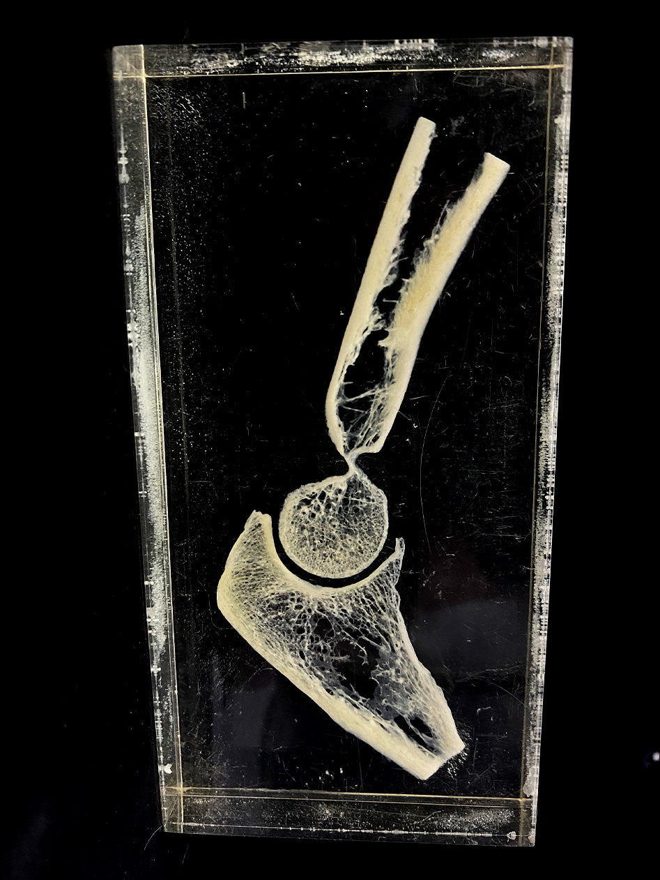 Cross Section Infant Child's Foot