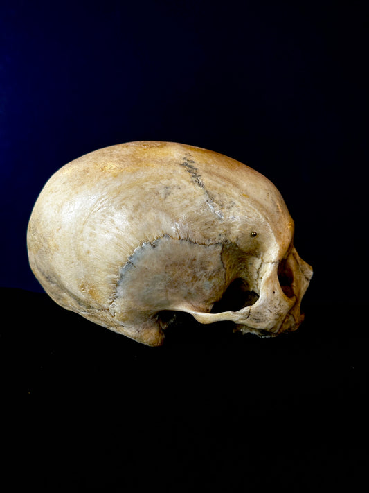 Uncut Skull : Slightly Elongated