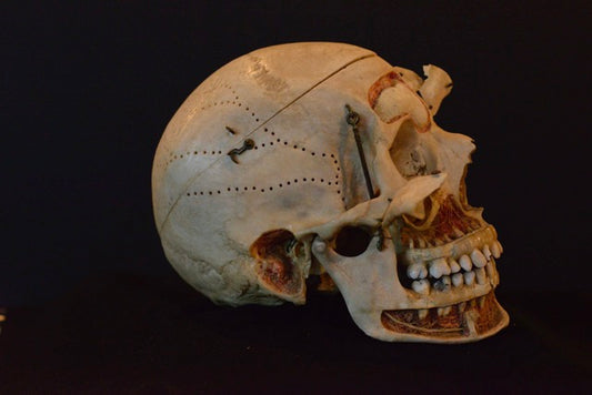 Authentic Human Skull Dissection