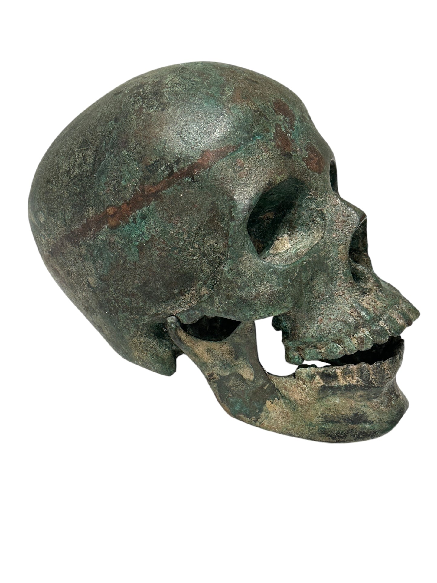 Life Size Bronze Skull with Articulated Jaw