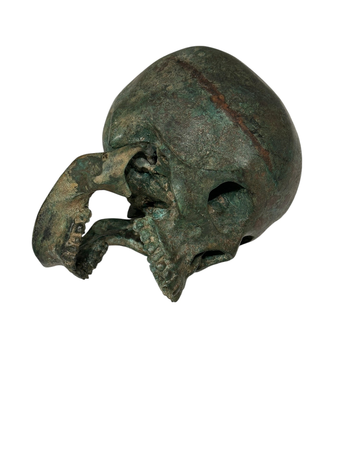 Life Size Bronze Skull with Articulated Jaw