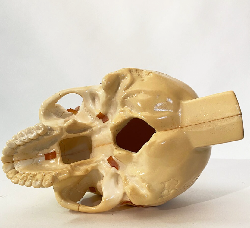 Medical Skull Model